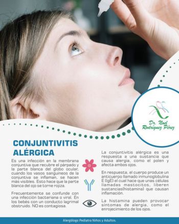 Conjuntivitis Alérgica